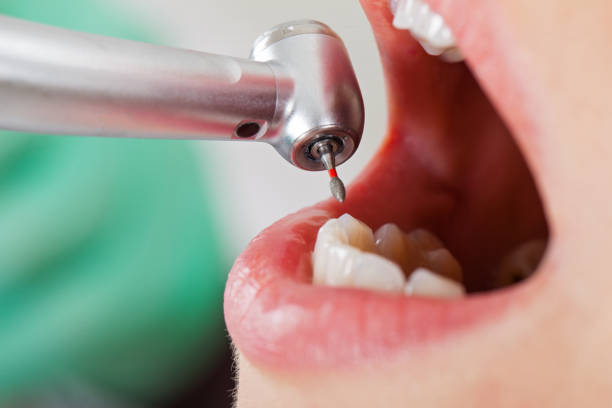  Bruce, MS Emergency Dentist Pros